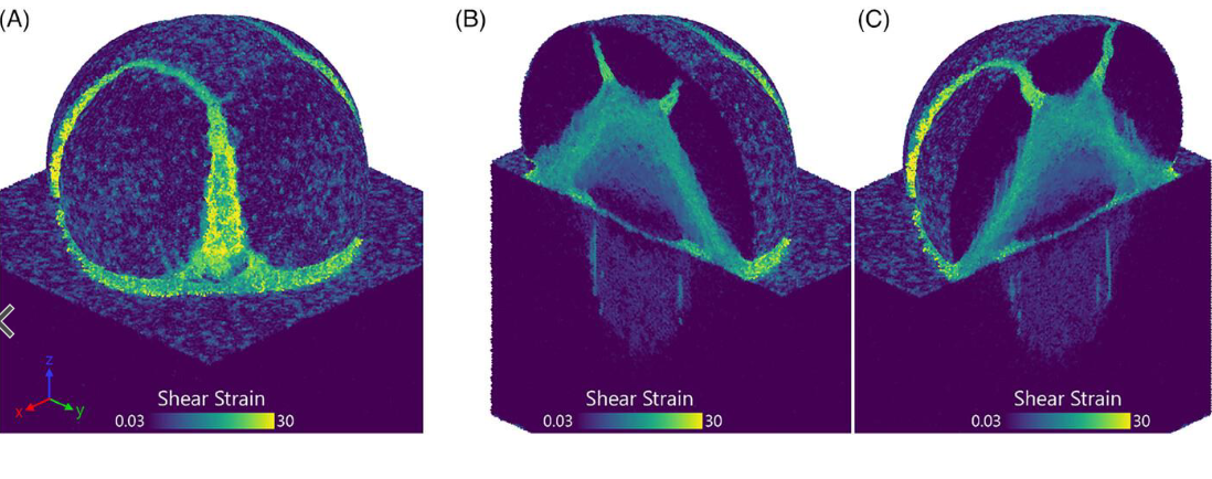 Shear strain density visualizations across three impact simulation cases in an alumina particle